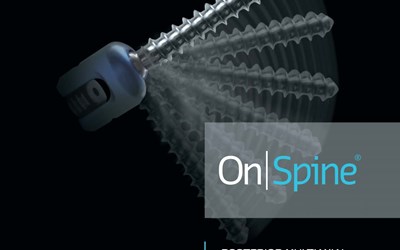 On | Spine ® ( Posteriro Lomber Sistem)
