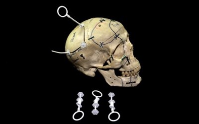 CRANIOSTOP KRANIAL FIKSASYON SISTEMI