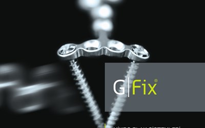 G | Fix ® ( Micro Plaklar 1.2 / 1.6 / 2.0 )