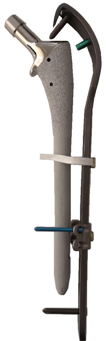 Ortholox® Locking Periprosthetic Support Cable-Plate Systems