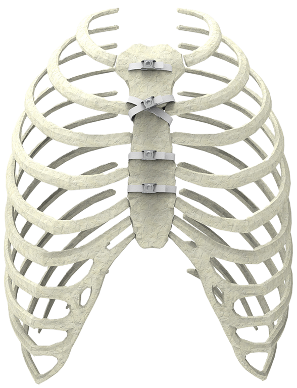Ortholox® UHMWPE Sternotomy Closure System