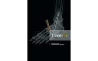 Three | Fix ® ( Canulated Screws )