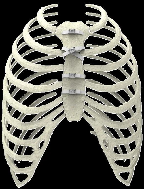 Ortholox® UHMWPE Sternotomy Closure System