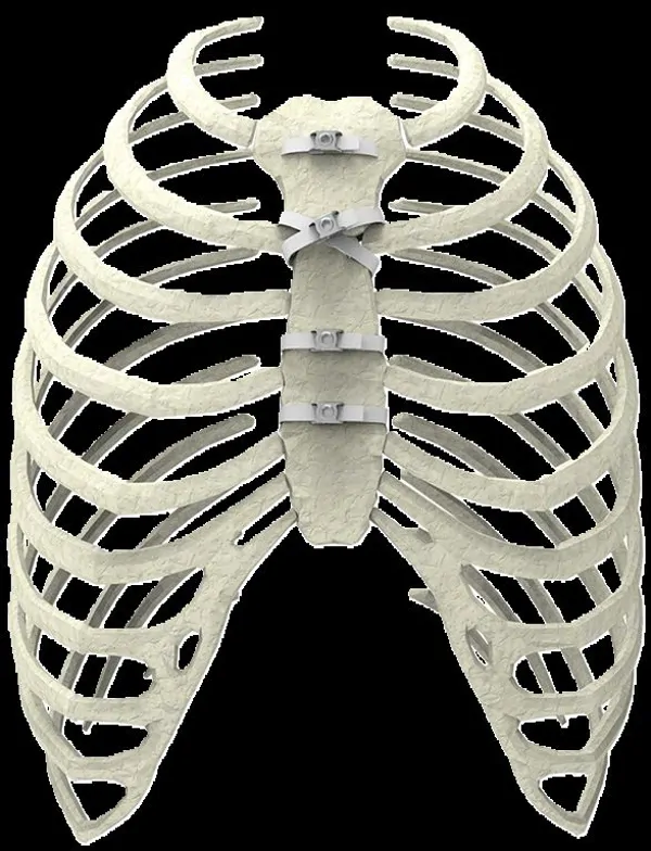 Ortholox® UHMWPE Sternotomy Closure System